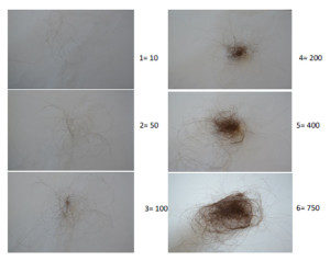 Normal hair fall deals