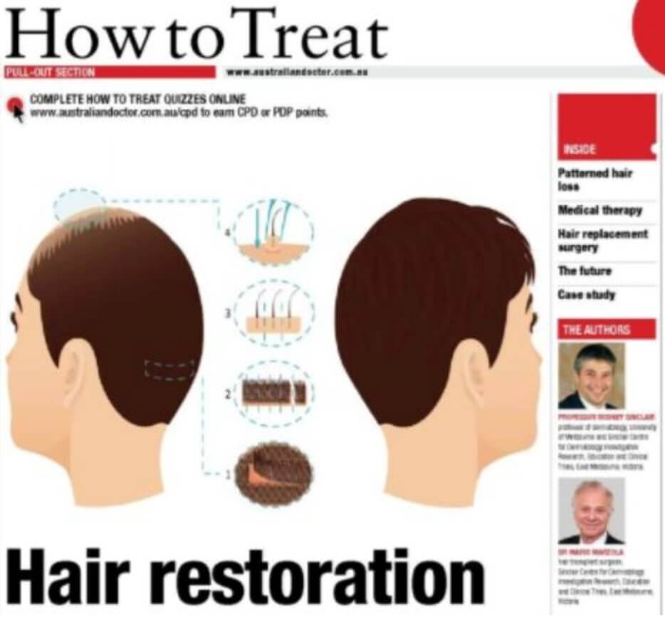 hair restoration treatments