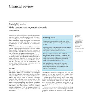 male pattern androgenetic alopecia