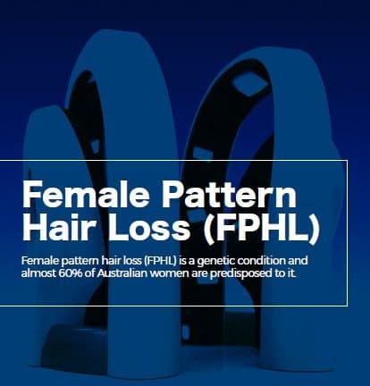 female pattern hair loss