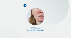 Seasonal rosacea triggers