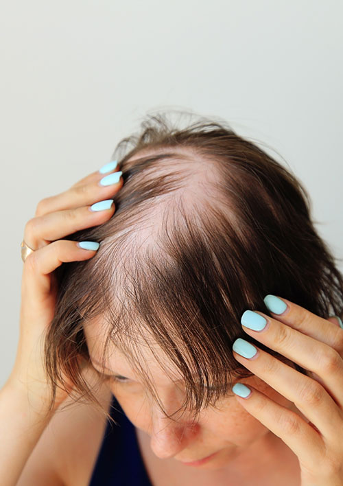 Trichology for hair and scalp conditions