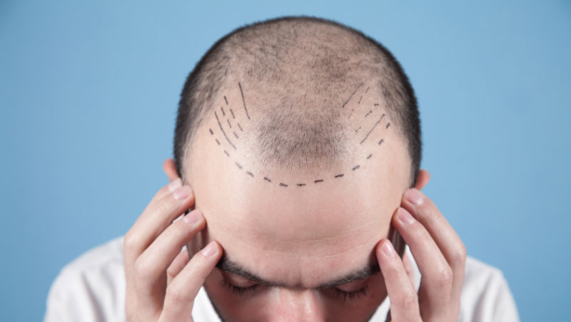 Your-treatment-journey-at-Sinclair-Dermatology
