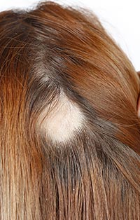 A temporary shedding