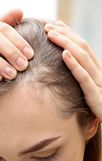 PCOS and hormonal imbalance