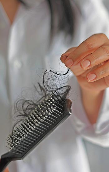 hair falling out